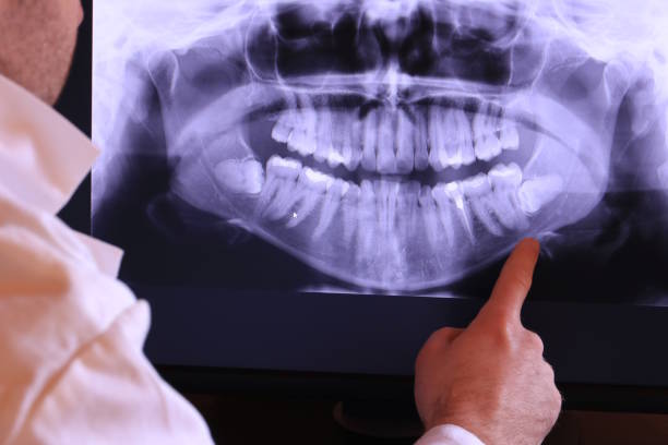 Best Weekend Emergency Dentist in Live Oak, TX