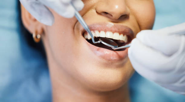 Best Emergency Treatment for Dental Infections or Abscesses in Live Oak, TX